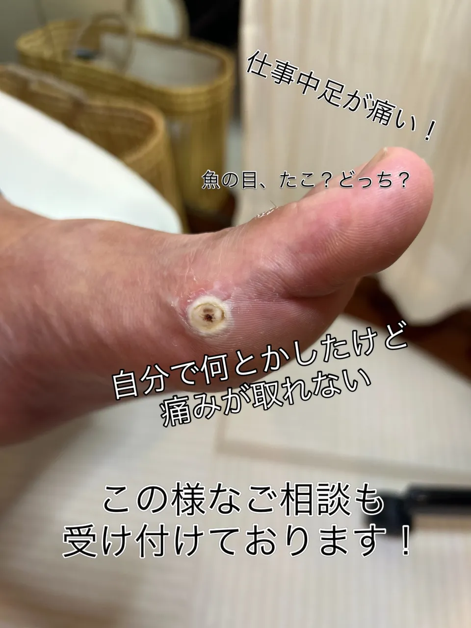 足が痛く来店されました。